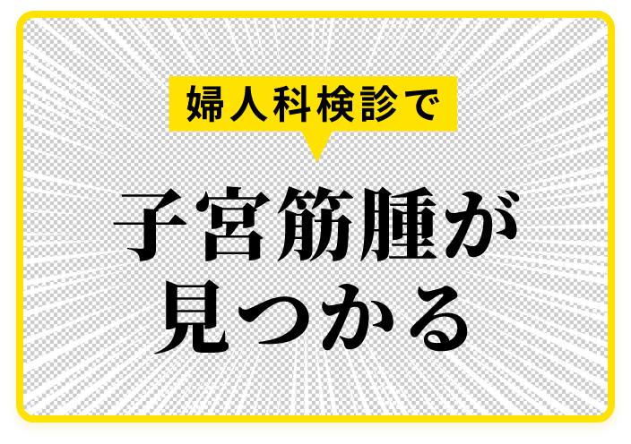 婦人科健診で子宮筋腫が見つかる